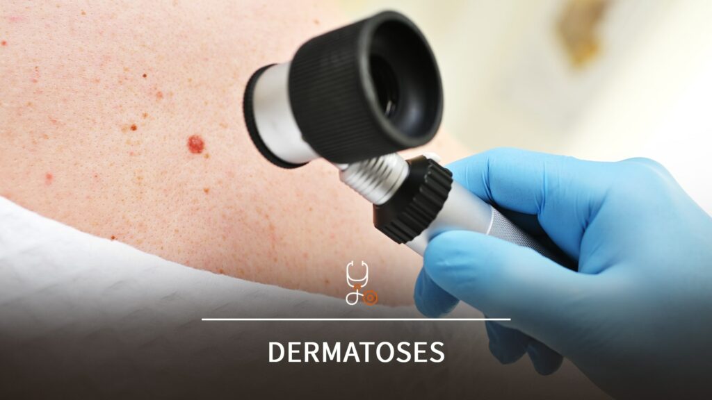 Un médecin examine la peau d’un patient à l’aide d’un dermatoscope, focalisé sur une lésion cutanée suspecte.