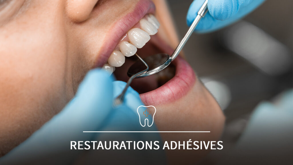 Un chirurgien-dentiste analyse la dentition d'une patiente à l’aide d’un instrument de précision, sous éclairage opératoire.