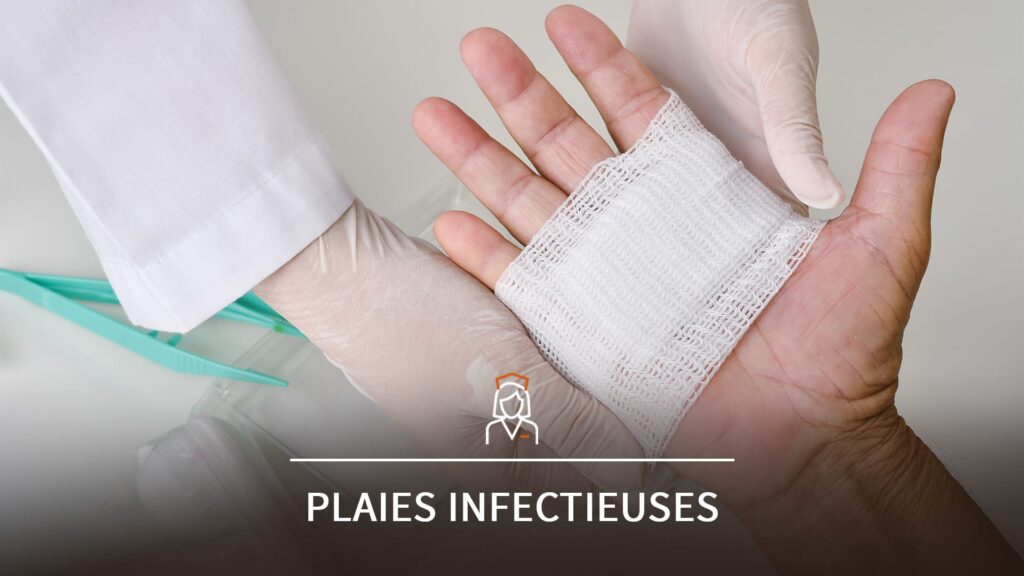 Soins infirmiers sur une plaie de la main bandée, prévention du risque infectieux